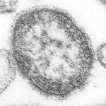 477px-Measles_virus